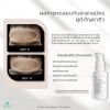 Eri Eden Intensive Serum Acne Solution & Skin Defense